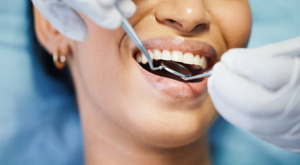 Best Emergency Dental Care for Broken or Chipped Teeth in Hagerstown, IN